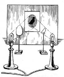 Fig. 91. Seudoradiograf&iacute;a.