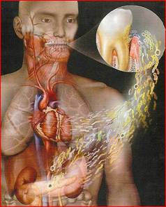 http://odontologia20.com/wp-content/uploads/2014/03/relacion-dental-cardiolog%C3%ADa.jpg